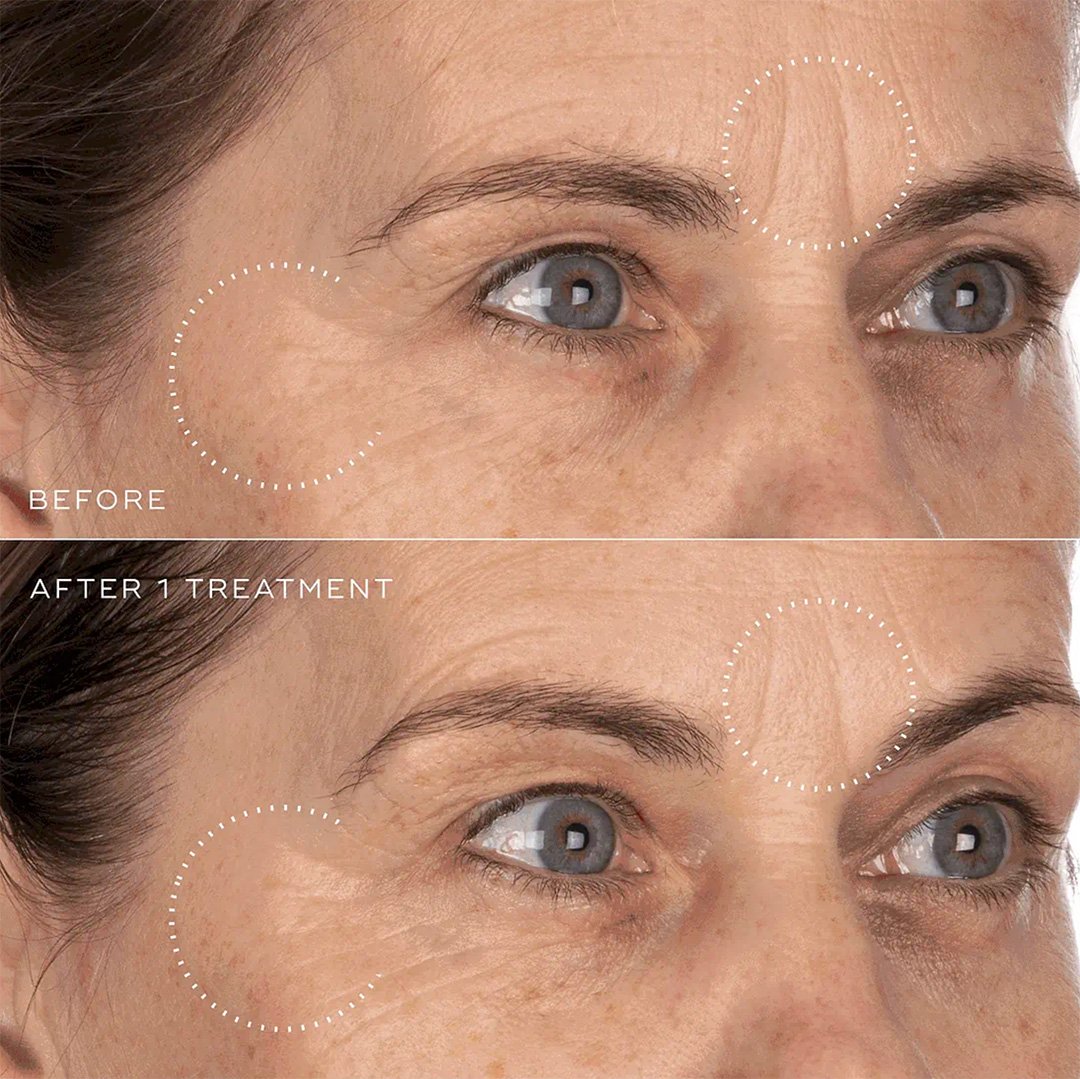 Medik8 Crystal Retinal Age-Defying Facial